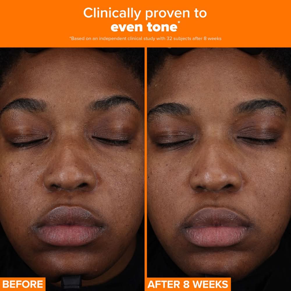 glutathione sephora Would I repurchase? Honestly… yes. .. this vitamin c range is love from  Sephora .. Lightweight, absorbs fast… , Results definitely take time .. but  it’s a good vit c range …. , #glowreel #vitcserum main image 0