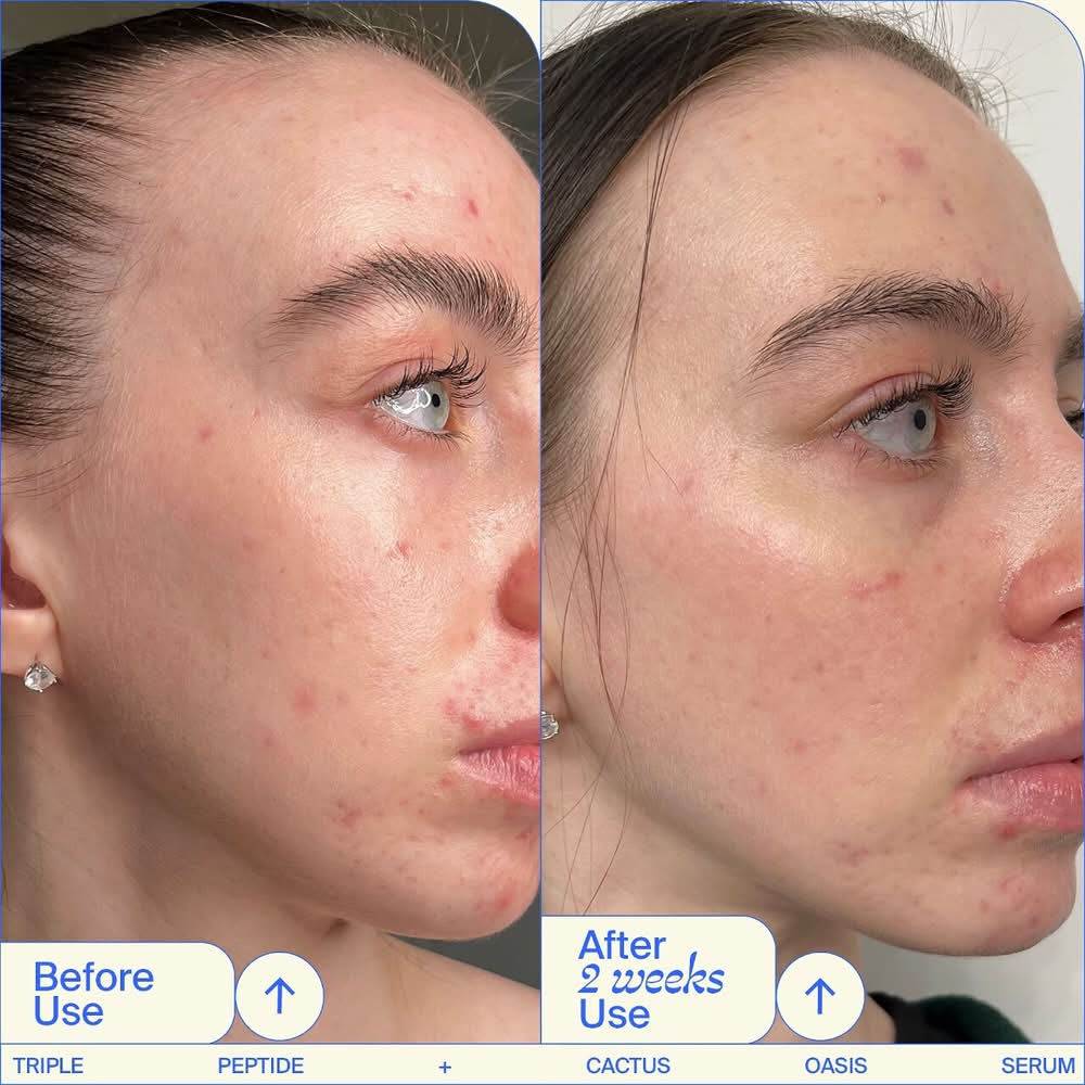 Youth To The People Triple Peptide Hydrating + Firming Oasis Serum With  Hyaluronic Acid Delivery Near Me | Order Online | Uber Eats